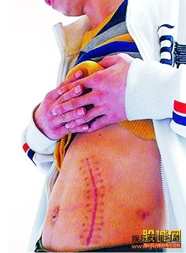 常州团伙“圈养”数十活人供卖肾 大多为年轻人让金钱所蒙蔽